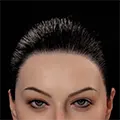 Schwarzes Haarimplantat