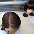Brown hair implanted